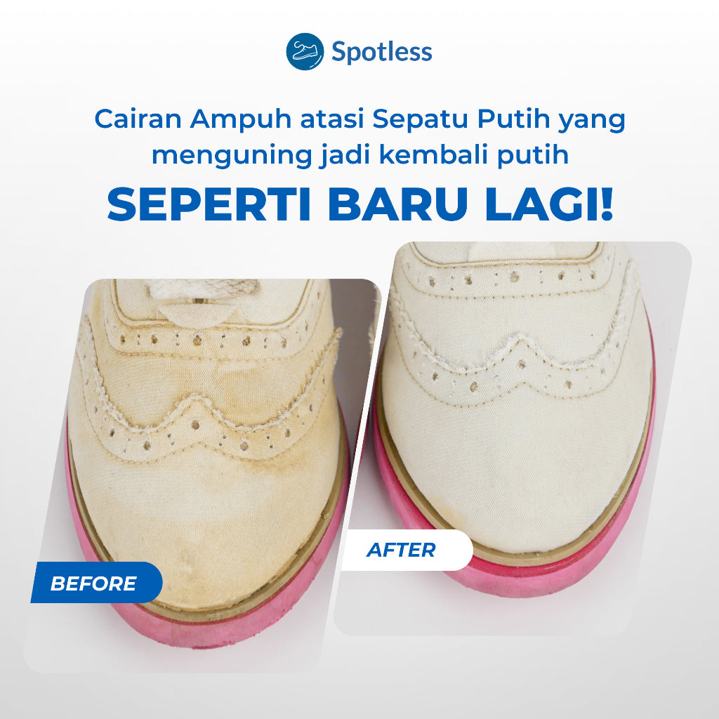 Spotless Whitening - Cairan Pemutih Penghilang Noda Kuning Sepatu dan Baju